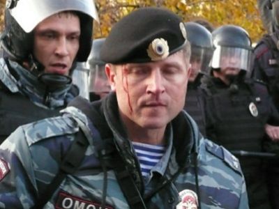 Пострадавший ОМОНовец в Бирюлево. Фото из блога eyra-0501.livejournal.com Пострадавший ОМОНовец в Бирюлево. Фото из блога eyra-0501.livejournal.com